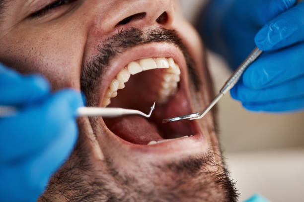 Fast & Reliable Emergency Dental Services in SD